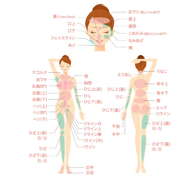 ラココの脱毛部位
