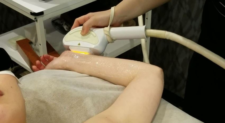 ヒジ下裏の照射