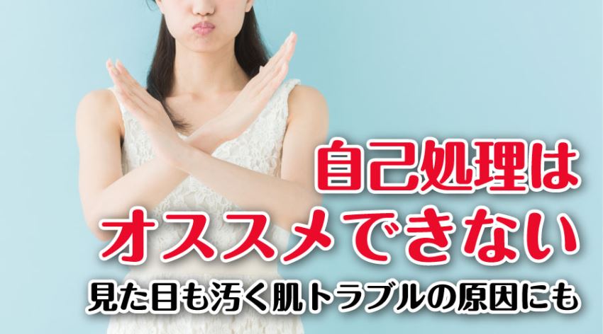 自己処理はオススメできない