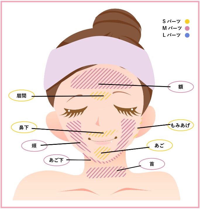 秋葉原中央クリニックの顔脱毛の対象部位