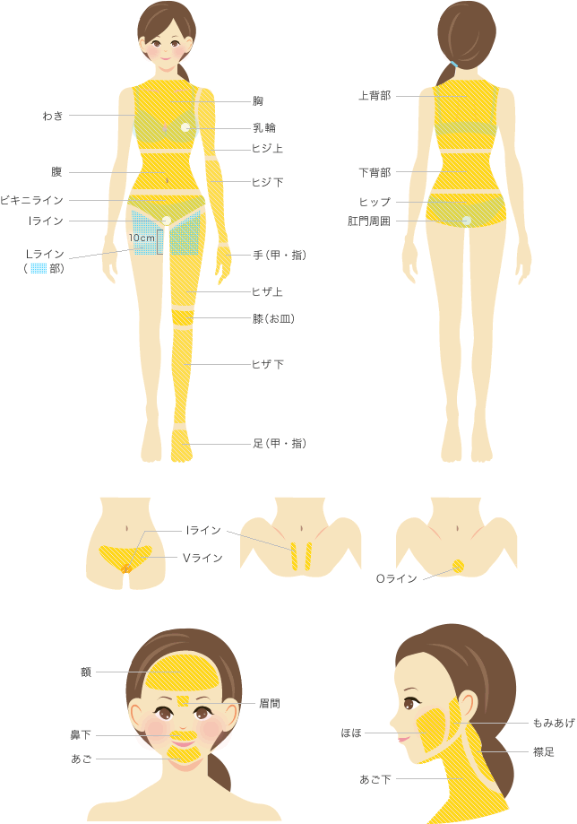 名古屋中央クリニックの全身脱毛対象部位