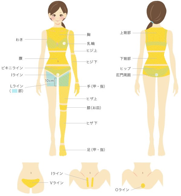 栄セントラルクリニックの全身脱毛対象部位