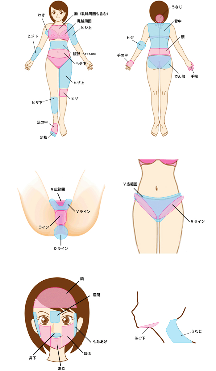 横浜中央クリニックの全身脱毛対象部位