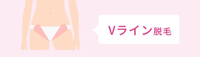 ミュゼVラインの脱毛範囲