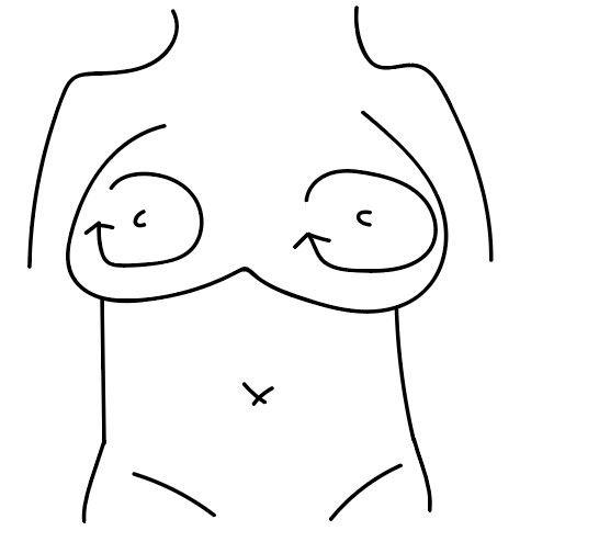 胸脱毛の施術イメージ