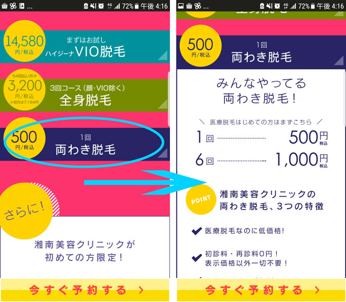 湘南美容クリニックの公式サイト（ワキ脱毛6回1,000円）