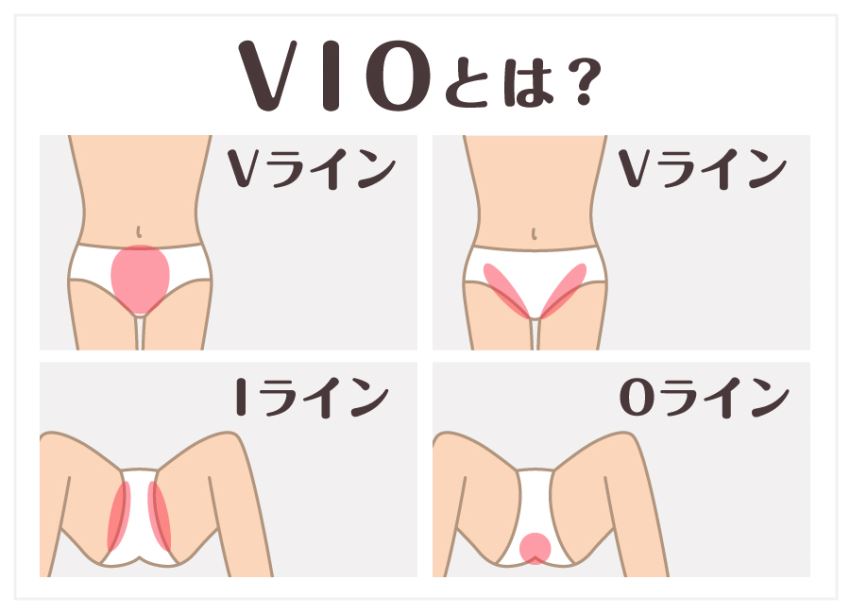 VIO脱毛とは?